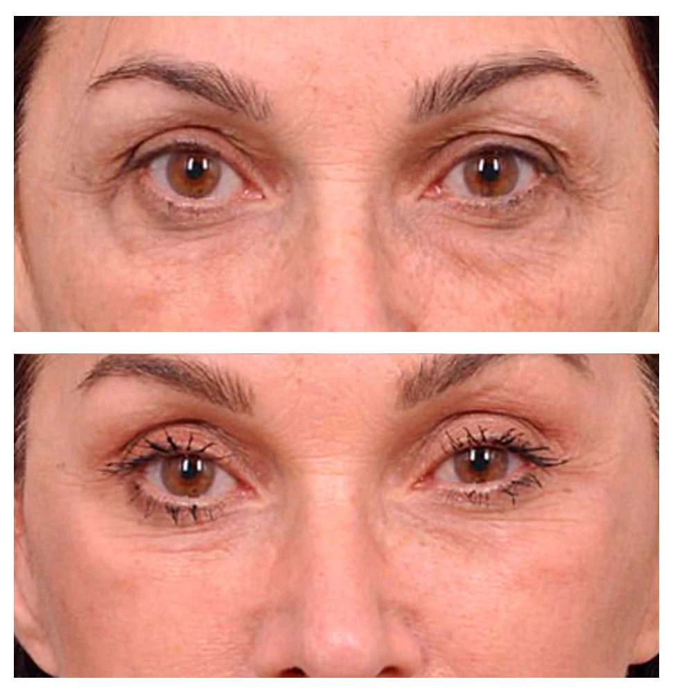Antes e depois 03 · resultado real