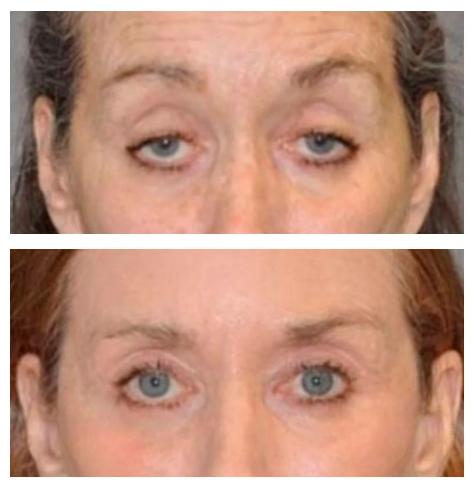 Antes e depois 04 · resultado real