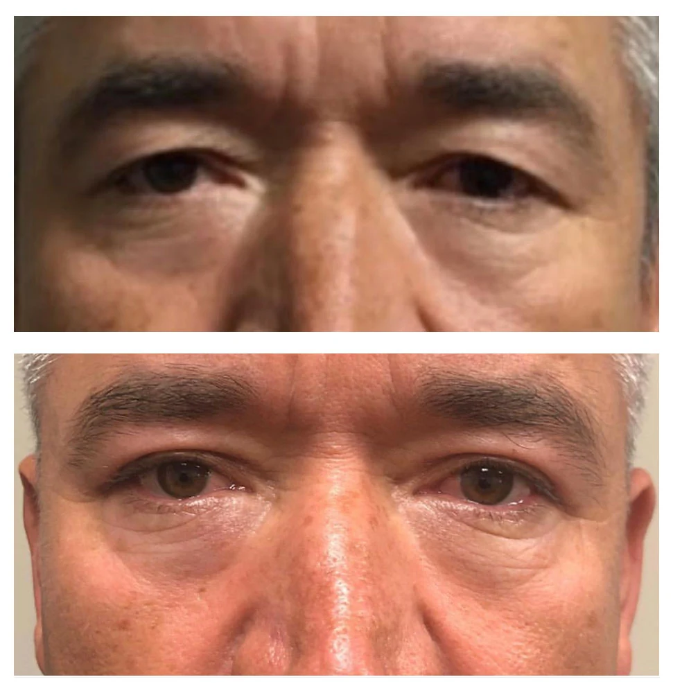 Antes e depois 05 · resultado real