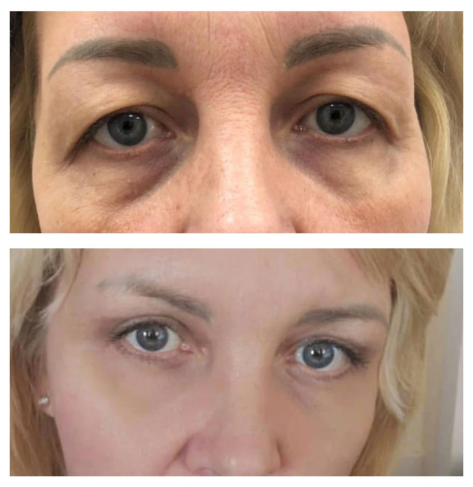 Antes e depois 07 · resultado real