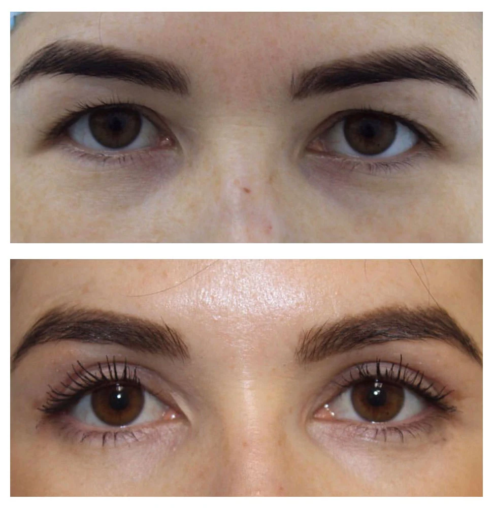 Antes e depois 08 · resultado real