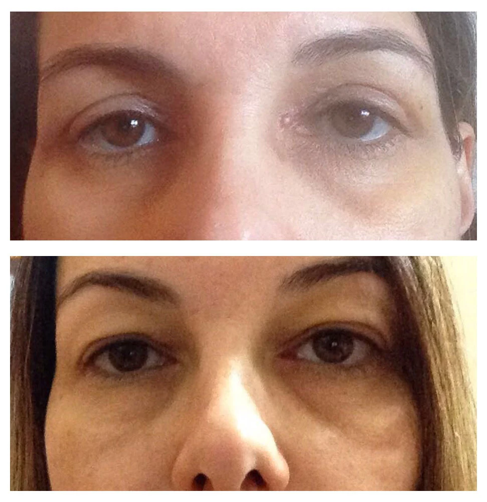 Antes e depois 09 · resultado real